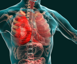 Banner Image displaying Pulmonary conditions developing in human body.