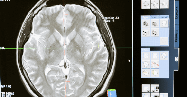 Neurological care PCT in Panama Stem Cells Therapies