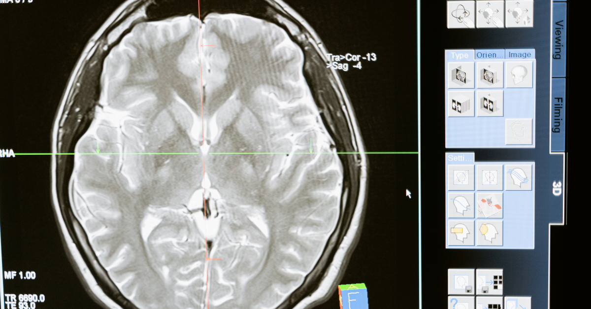 Neurological care PCT in Panama Stem Cells Therapies