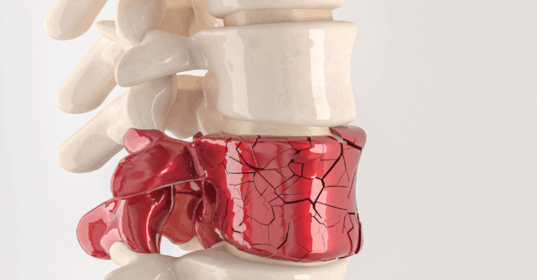 back & spine pain relief