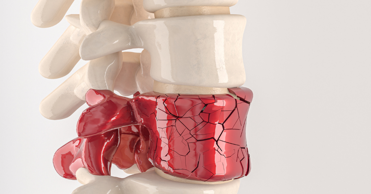 back & spine pain relief