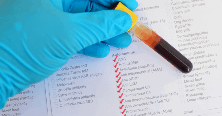 autoimmune disorder stem cell care