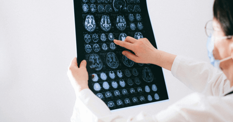 Neurological stem cell relief