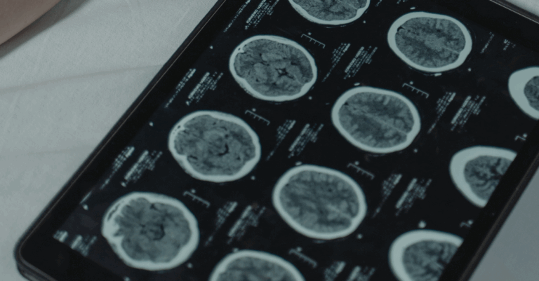 Neurological stem cell care therapy and care