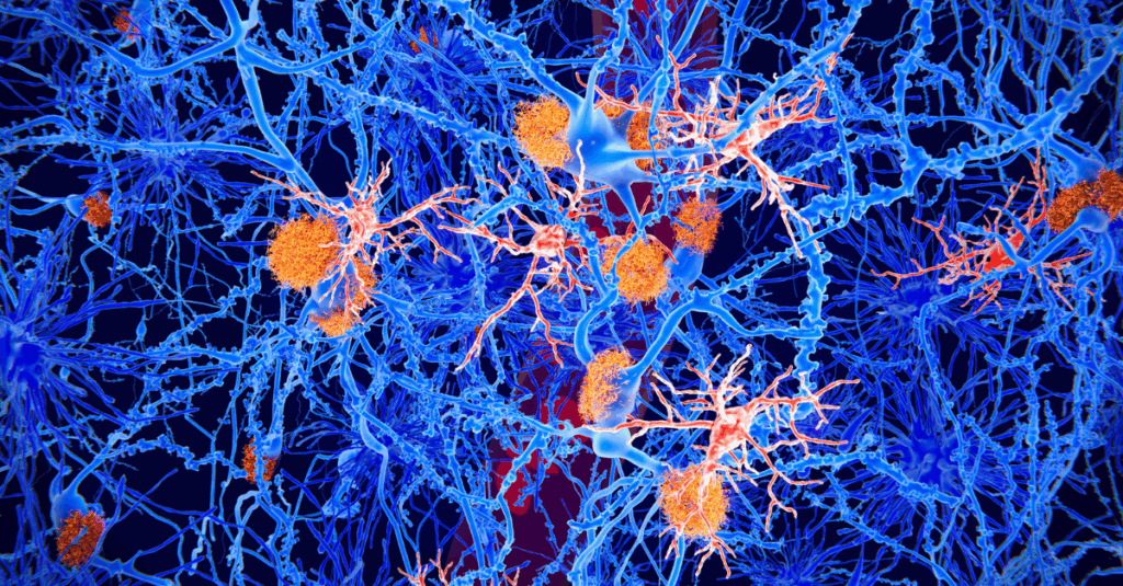 Revolutionizing Brain Health: The Rise of Stem Cell Therapy for ...
