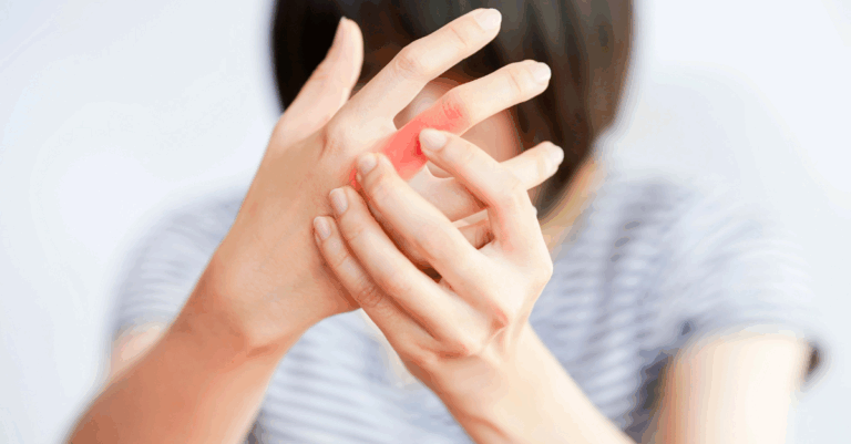 autoimmune help PCT
