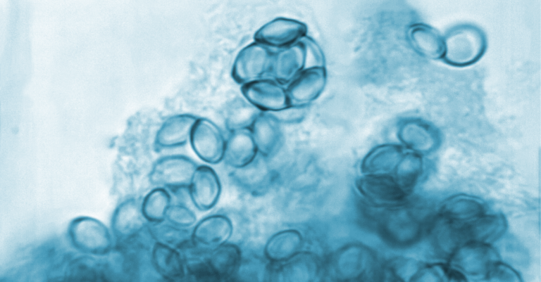 autoimmune diseases PCT Panama stem cell therapy