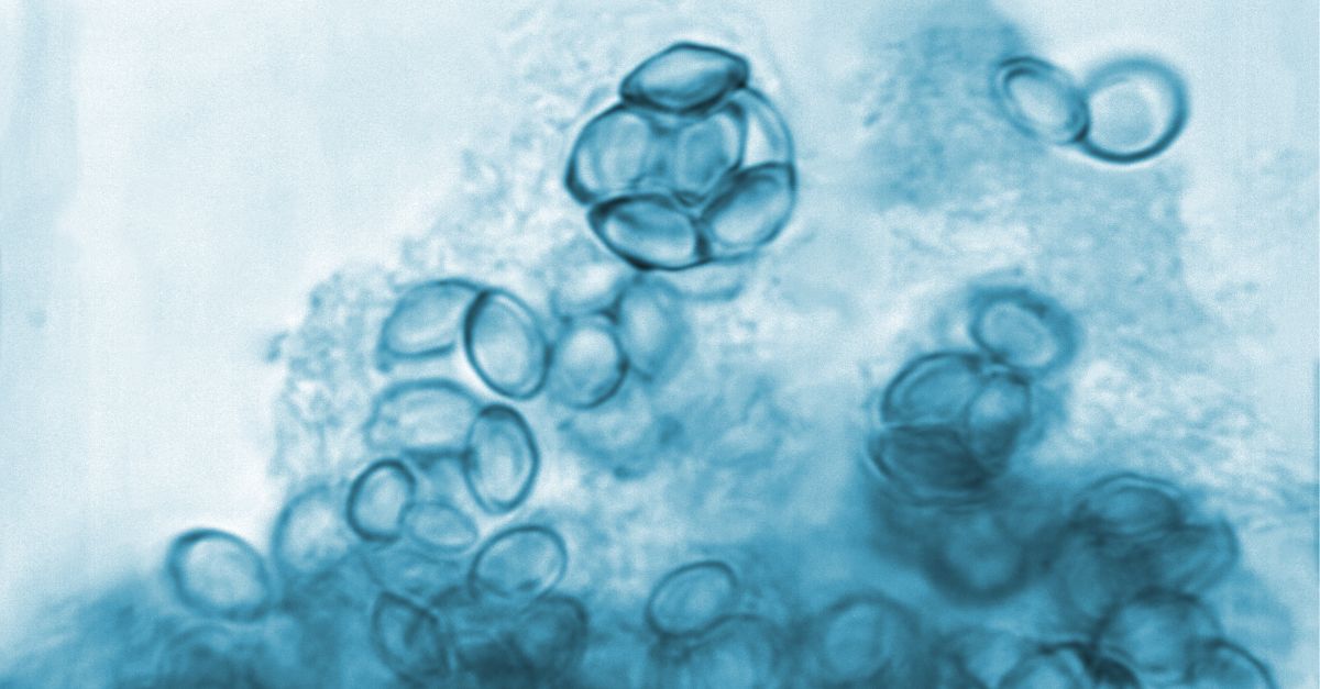 autoimmune diseases PCT Panama stem cell therapy