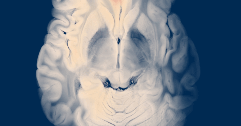 brain issues and stem cells