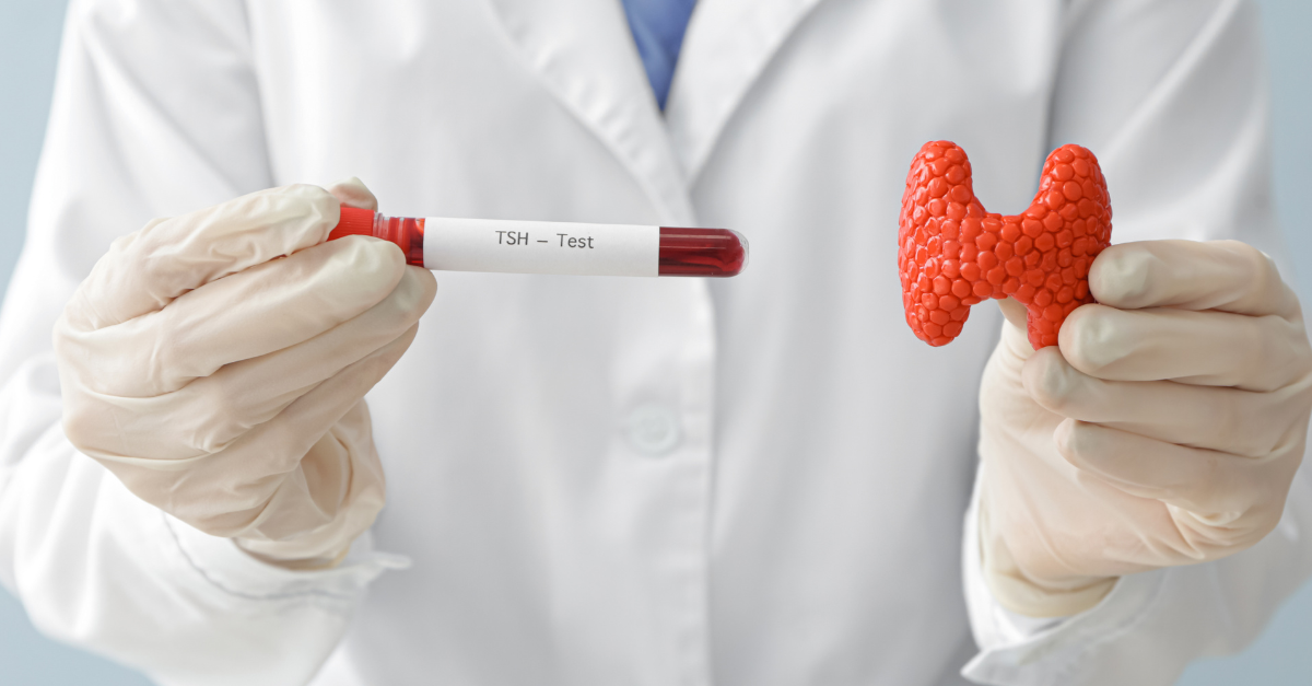 autoimmune diseases resolution with stem cells PCT Panama