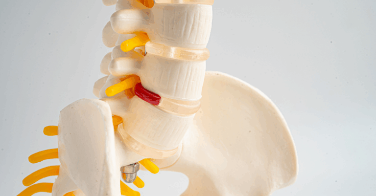 Back and spine care and support for PCT Panama