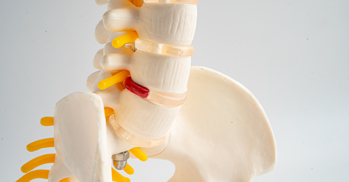 Back and spine care and support for PCT Panama