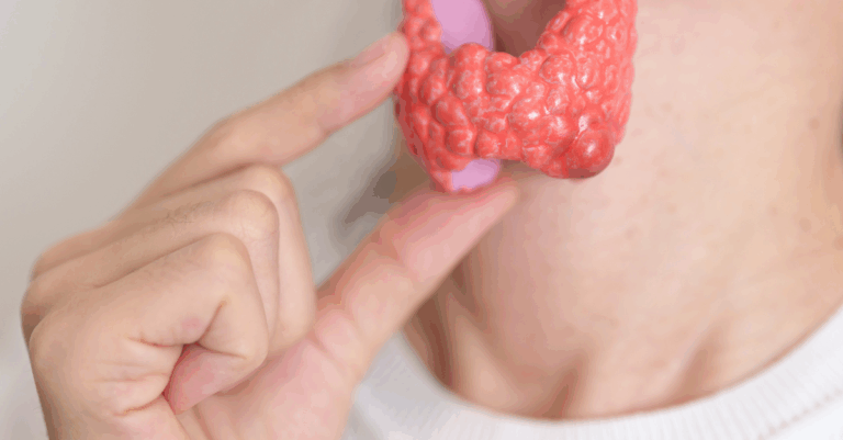 autoimmune disorders at PCT Panama at Panama