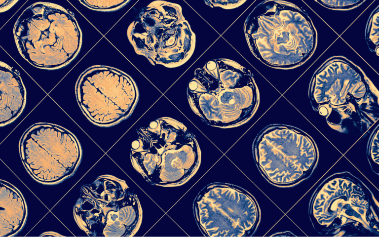 neuro pct relief and care