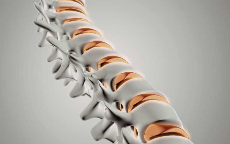 spine related condition's resolution at PCT Panama.