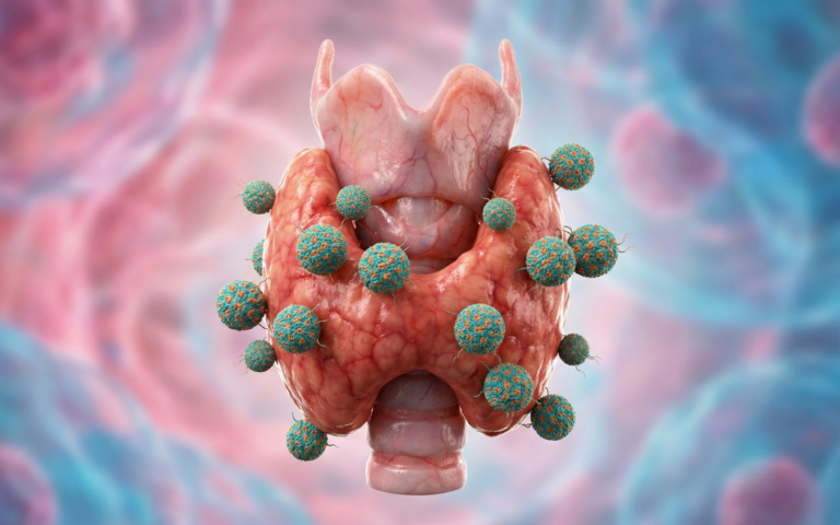 autoimmune illness help & solutions at PCT Panama