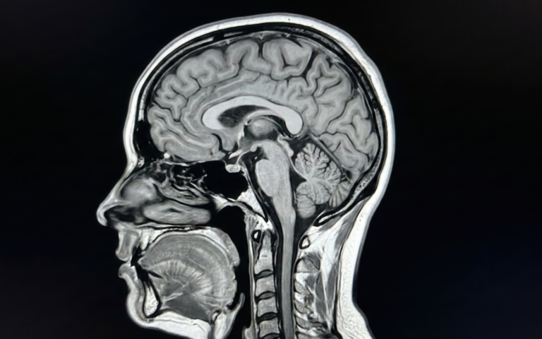 neuro care and issues PCT