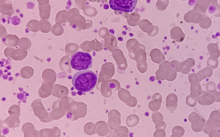 autoimmune care and solutions at PCT Panama