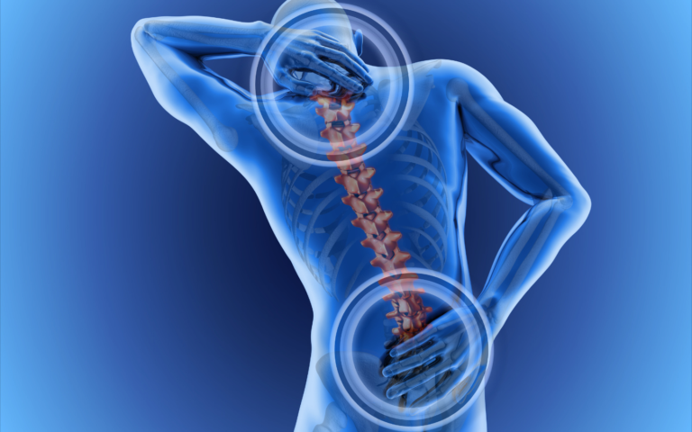 back and spine issues relief and care with Panama Cell Therapies